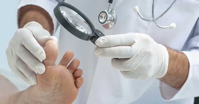 Ekzaminimi diagnostik i thonjve të këmbëve
